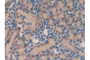 DAB staining on IHC-P; Samples: Rat Kidney Tissue (MMP23A 抗体  (AA 71-383))