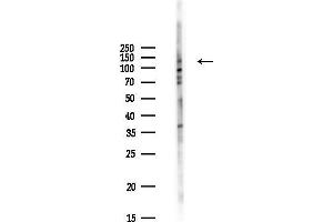 Western blot analysis of lysates from Hela cells(UV,30 min treatment), using PARB Antibody at 1/1000 dilution.