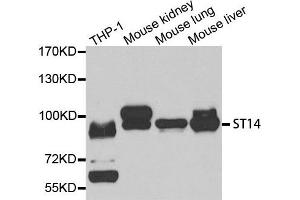 Western Blotting (WB) image for anti-Suppression of Tumorigenicity 14 (Colon Carcinoma) (ST14) antibody (ABIN1877121) (ST14 抗体)