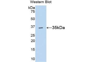 Detection of Recombinant CCND1, Rat using Polyclonal Antibody to Cyclin D1 (CCND1) (Cyclin D1 抗体  (AA 1-295))