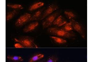 Immunofluorescence analysis of H9C2 cells using OTUB1 Polyclonal Antibody at dilution of 1:100. (OTUB1 抗体)