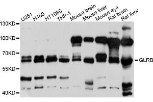 Western blot analysis of extracts of various cell lines, using GLRB antibody (ABIN4903772) at 1:1000 dilution. (GLRB 抗体)