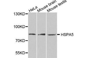 Western blot analysis of extracts of various cell lines, using HSPA5 antibody. (GRP78 抗体  (AA 550-650))