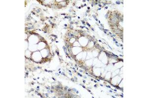 Immunohistochemistry of paraffin-embedded human colon using N antibody (ABIN6133455, ABIN6144330, ABIN6144331 and ABIN6223249) at dilution of 1:200 (40x lens). (NAT15 抗体  (AA 1-242))