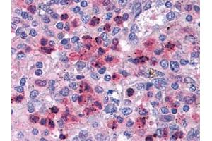 Immunohistochemistry (IHC) image for anti-Interferon Regulatory Factor 4 (IRF4) (AA 342-452) antibody (ABIN614626)