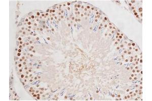 ABIN6267354 at 1/200 staining Rat testis tissue sections by IHC-P.