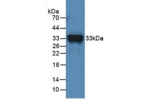 Detection of Recombinant F11, Mouse using Polyclonal Antibody to Coagulation Factor XI (F11) (Factor XI 抗体  (AA 157-389))