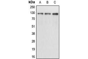 Western blot analysis of CD167a expression in A431 (A), K562 (B), T47D (C) whole cell lysates. (DDR1 抗体  (Center))