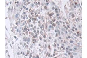 Immunohistochemistry (IHC) image for anti-Exosome Component 2 (EXOSC2) (AA 1-293) antibody (ABIN7441514)