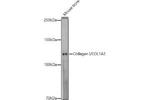 Western blot analysis of extracts of Mouse bone, using Collagen I/COL1 antibody (1059) at 1:1000 dilution. (COL1A2 抗体)