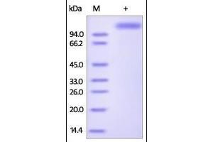 SDS-PAGE (SDS) image for Hemagglutinin (HA) (AA 19-338), (AA 341-523) protein (Fc Tag) (ABIN2181208)