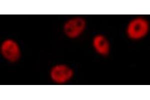 ABIN6266463 staining Hela by IF/ICC. (Retinoic Acid Receptor alpha 抗体  (pSer77))