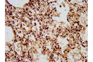 IHC image of ABIN7175834 diluted at 1:500 and staining in paraffin-embedded human lung tissue performed on a Leica BondTM system. (WASF2 抗体  (AA 243-317))