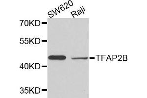 Western Blotting (WB) image for anti-Transcription Factor AP-2 beta (Activating Enhancer Binding Protein 2 Beta) (TFAP2B) antibody (ABIN2737673)