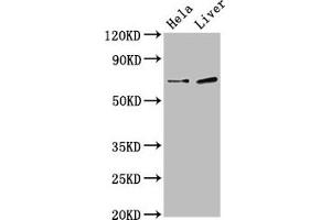 Western Blot Positive WB detected in: Hela whole cell lysate, Rat liver tissue All lanes: SSX2IP antibody at 3 μg/mL Secondary Goat polyclonal to rabbit IgG at 1/50000 dilution Predicted band size: 72, 66, 69 kDa Observed band size: 72 kDa