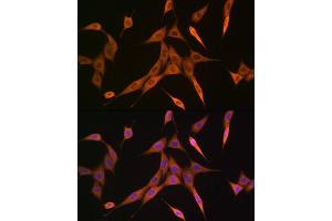 Immunofluorescence analysis of NIH-3T3 cells using RHOA/RHOB/RHOC Rabbit mAb (ABIN1678636, ABIN3019244, ABIN3019245 and ABIN7101735) at dilution of 1:100 (40x lens). (RhoA,B,C 抗体)