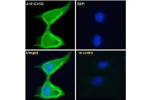 ABIN2613438 Immunofluorescence analysis of paraformaldehyde fixed NIH3T3 cells, permeabilized with 0.