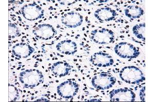 Image no. 8 for anti-B-Raf proto-oncogene, serine/threonine kinase (BRAF) antibody (ABIN1496954)