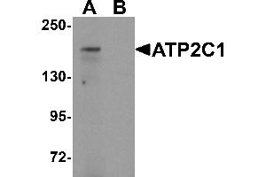 Western blot analysis of ATP2C1 in mouse brain tissue lysate with ATP2C1 antibody at 1 µg/mL in (A) the absence and (B) the presence of blocking peptide. (ATP2C1 抗体  (C-Term))