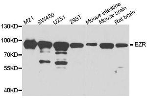 Western blot analysis of extracts of various cell lines, using EZR antibody. (Ezrin 抗体  (AA 350-470))