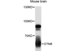 Western blot analysis of extracts of mouse brain, using DTNB antibody (ABIN6294202) at 1:3000 dilution. (Dystrobrevin beta 抗体)