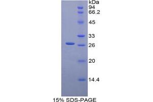 SDS-PAGE analysis of Mouse Glucuronidase beta Protein. (Glucuronidase beta 蛋白)