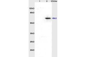 Lane 1: rat brain lysates Lane 2: rat heart lysates probed with Anti hospho-Paxillin (Tyr118) Polyclonal Antibody, Unconjugated (ABIN745043) at 1:200 in 4 °C. (Paxillin 抗体  (pTyr118))