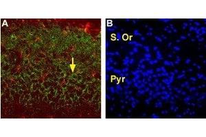 Immunohistochemistry (IHC) image for anti-Solute Carrier Family 1 (Glial High Affinity Glutamate Transporter), Member 2 (SLC1A2) (Extracellular) antibody (ABIN7043660)