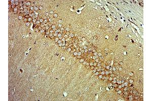 Paraformaldehyde-fixed, paraffin embedded mouse brain, Antigen retrieval by boiling in sodium citrate buffer (pH6) for 15min, Block endogenous peroxidase by 3% hydrogen peroxide for 30 minutes, Blocking buffer (normal goat serum) at 37°C for 20min, Antibody incubation with MAP3K13 Polyclonal Antibody  at 1:400 overnight at 4°C, followed by a conjugated secondary and DAB staining. (MAP3K13 抗体  (AA 801-900))