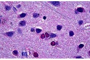 Human Brain, Cortex: Formalin-Fixed, Paraffin-Embedded (FFPE) (EBF3 抗体)