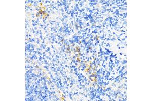 Immunohistochemistry of paraffin-embedded mouse spleen using CAMP antibody (ABIN3022305, ABIN3022306, ABIN3022307, ABIN1512664 and ABIN6218724) at dilution of 1:200 (40x lens). (Cathelicidin 抗体  (AA 31-170))