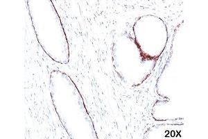 IHC staining of human prostate (20X) with HMW Cytokeratin antibody (34bE12).