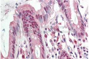 Rabbit Anti-RAD23B antibody Catalog Number: ARP56505 Formalin Fixed Paraffin Embedded Tissue: Human Adult Colon  Observed Staining: Cytoplasm in hepatocytes Primary Antibody Concentration: 1:600 Secondary Antibody: Donkey anti-Rabbit-Cy3 Secondary Antibody Concentration: 1:200 Magnification: 20X Exposure Time: 0. (RAD23B 抗体  (Middle Region))