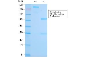 SDS-PAGE Analysis Purified MALT1 Recombinant Rabbit Monoclonal Antibody (MT1/3159R). (Recombinant MALT1 抗体  (AA 701-808))