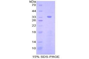 SDS-PAGE analysis of Mouse Nucleoredoxin Protein.
