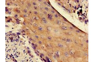 Immunohistochemistry (IHC) image for anti-Ribosomal Protein S4, Y-Linked 1 (RPS4Y1) (AA 197-263), (Isoform 1) antibody (ABIN7142559)