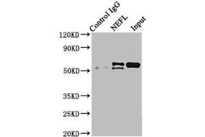 Immunoprecipitating NEFL in mouse brain tissue Lane 1: Rabbit control IgG instead of ABIN7161278 in mouse brain tissue. (NEFL 抗体  (AA 128-271))