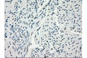 Immunohistochemical staining of paraffin-embedded endometrium tissue using anti-FCGR2A mouse monoclonal antibody. (FCGR2A 抗体)