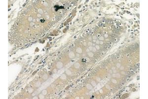 ABIN6261221 and ABIN6278110 at 1/100 staining human normal colon tissue by IHC-P.