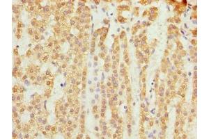 Immunohistochemistry (IHC) image for anti-Solute Carrier Family 25 (Mitochondrial Carrier), Member 18 (SLC25A18) (AA 246-287) antibody (ABIN7159878)