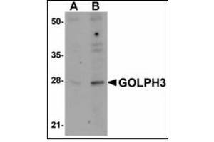 Western blot analysis of GOLPH3 in rat lung tissue lysate with GOLPH3 antibody at (A) 0. (GOLPH3 抗体  (N-Term))