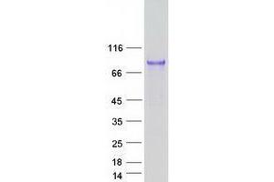 Western Blotting (WB) image for Uromodulin (UMOD) (Transcript Variant 1) protein (Myc-DYKDDDDK Tag) (ABIN2735074)