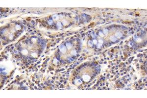 Detection of CD3e in Human Small intestine Tissue using Polyclonal Antibody to T-Cell Surface Glycoprotein CD3 Epsilon (CD3e) (CD3 epsilon 抗体  (AA 28-185))