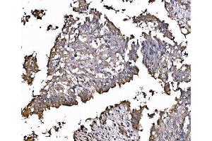 IHC analysis of FXR1 using anti-FXR1 antibody (ABIN7600093). (FXR1 抗体  (AA 149-614))