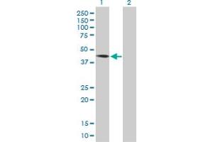 Western Blot analysis of DYX1C1 expression in transfected 293T cell line by DYX1C1 MaxPab polyclonal antibody. (DYX1C1 抗体  (AA 1-381))