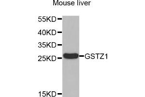 Western blot analysis of extracts of Mouse liver , using GSTZ1 antibody. (GSTZ1 抗体)