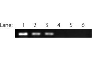 RbAp46/48 antibody (pAb) tested by ChIP ChIP performed on MCF7 cell chromatin (40 μg) using 39198. (RbAp46/48 抗体)