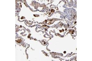 Immunohistochemical staining of human lung with C1QA polyclonal antibody  shows strong cytoplasmic positivity in macrophages. (C1QA 抗体)