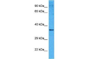 Host:  Mouse  Target Name:  PITX1  Sample Tissue:  Mouse Kidney  Antibody Dilution:  1ug/ml (PITX1 抗体  (Middle Region))