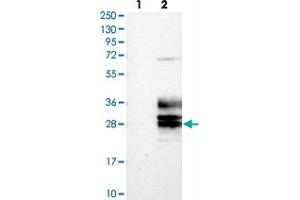 Western blot analysis of Lane 1: Negative control (vector only transfected HEK293T lysate), Lane 2: Over-expression Lysate (Co-expressed with a C-terminal myc-DDK tag (~3. (Clarin 3 抗体)